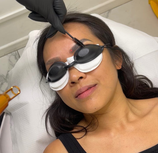 2 SESSIONS OF LASER WITH NEW BROWS